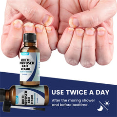 Fungal Nail Treatment Serum – Anti-Fungal Repair Gel for Foot & Nail Care | Onychomycosis & Paronychia Solution