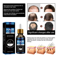 Hair Growth Oil – Effective Solution for Rapid Repair, Baldness, Postpartum Hair Loss & Hereditary Follicle Support