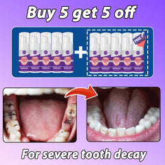Fast-Acting Cavity & Tooth Decay Solution | Strengthens Enamel & Fights Caries