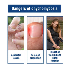 Fungal Nail Treatment Serum – Anti-Fungal Repair Gel for Foot & Nail Care | Onychomycosis & Paronychia Solution