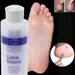 30/177ml Foot Cuticle Remover | Dead Skin & Callus Exfoliator | Softens & Repairs | Pedicure & Nail Enhancer