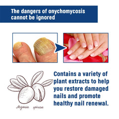 Fungal Nail Treatment Serum – Anti-Fungal Repair Gel for Foot & Nail Care | Onychomycosis & Paronychia Solution