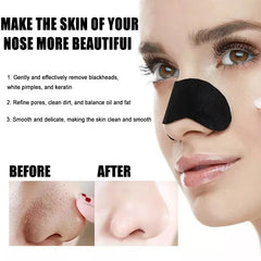 Facial Blackhead Removal Stickers – 10/50/100 Pieces for Deep Pore & Nose Cleansing, Gentle Care