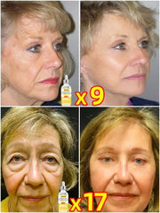 Facial Care & Skin Nourishment | Quick Solution for Healthy & Protected Skin