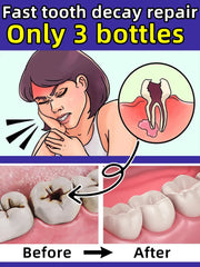 Fast-Acting Cavity & Tooth Decay Solution | Strengthens Enamel & Fights Caries