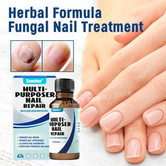 Fungal Nail Treatment Serum – Anti-Fungal Repair Gel for Foot & Nail Care | Onychomycosis & Paronychia Solution