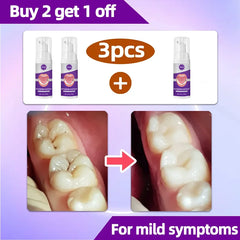 Advanced Tooth Decay Solution | Fights Cavities & Strengthens Enamel for a Healthy Smile