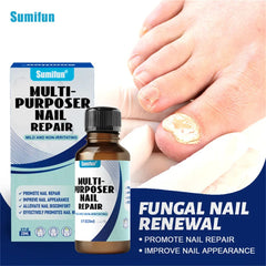 Fungal Nail Treatment Serum – Anti-Fungal Repair Gel for Foot & Nail Care | Onychomycosis & Paronychia Solution