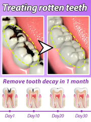 Fast-Acting Cavity & Tooth Decay Solution | Strengthens Enamel & Fights Caries