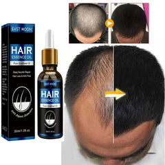 Hair Growth Oil – Effective Solution for Rapid Repair, Baldness, Postpartum Hair Loss & Hereditary Follicle Support