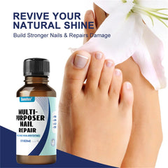 Fungal Nail Treatment Serum – Anti-Fungal Repair Gel for Foot & Nail Care | Onychomycosis & Paronychia Solution