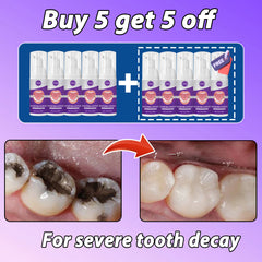 Ultimate Cavity & Tooth Decay Solution | Fights Caries & Strengthens Enamel