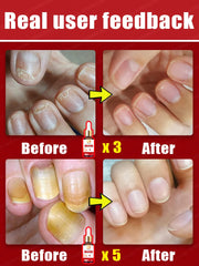 Ultimate Nail Repair Solution | Strengthens, Restores & Protects | Fights Brittle & Damaged Nails
