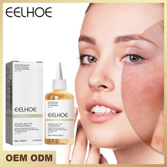 100ml Glycolic Acid Toning Solution – Acne Remover, Wrinkle Lifter & Firming Facial Toner for Glowing Skin