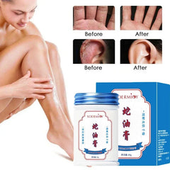 Herbal Anti Crack Foot Cream Heel Cracking Repair Products Exfoliation Dead Skin Removal Softening Moisturize Smooth Skin Care