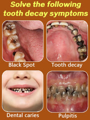 Advanced Tooth Decay Solution | Fights Cavities & Strengthens Enamel for a Healthy Smile