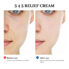 345 Relief Cream – Comprehensive Solution for Skin Problems, Anti-Sugar, Antioxidant, and Acne Mark Brightening