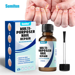 Fungal Nail Treatment Serum – Anti-Fungal Repair Gel for Foot & Nail Care | Onychomycosis & Paronychia Solution