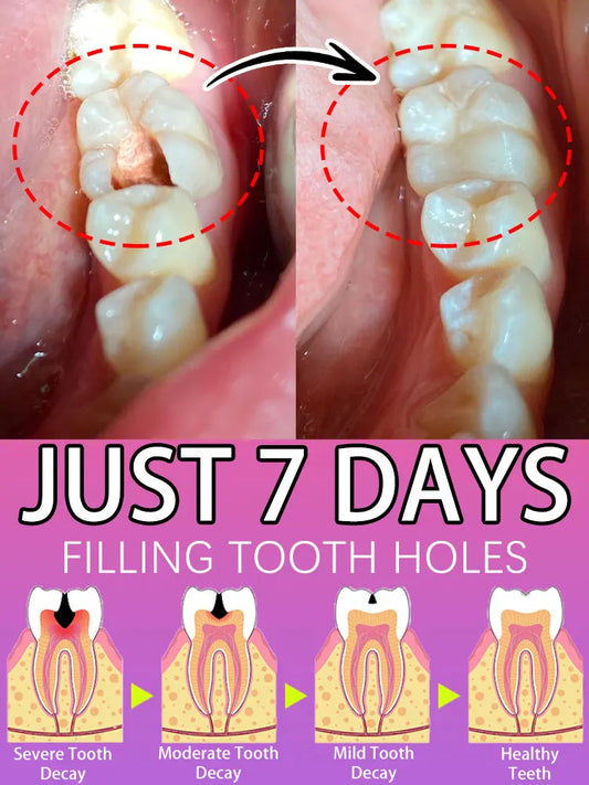 Advanced Tooth Decay Solution | Fights Cavities & Strengthens Enamel for a Healthy Smile