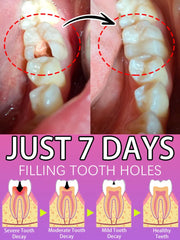 Advanced Tooth Decay Solution | Fights Cavities & Strengthens Enamel for a Healthy Smile