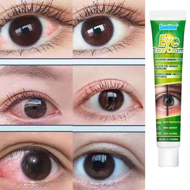 Chinese Herbal Medicine Eye Care Cream Relieve Eye Fatigue Brighter Looking Eyes Problems Reduces Dark Circles And Puffiness