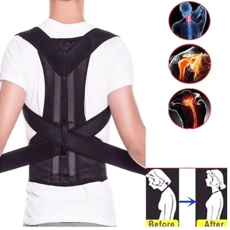 Adjustable Back Posture Corrector With Breathable Shoulder And Waist Support Straps For Boys And Girls To Relieve Back Pain