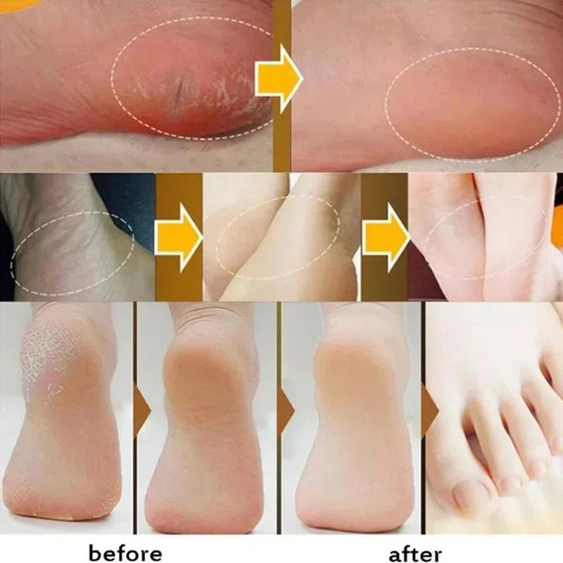 Herbal Anti Crack Foot Cream Heel Cracking Repair Products Exfoliation Dead Skin Removal Softening Moisturize Smooth Skin Care