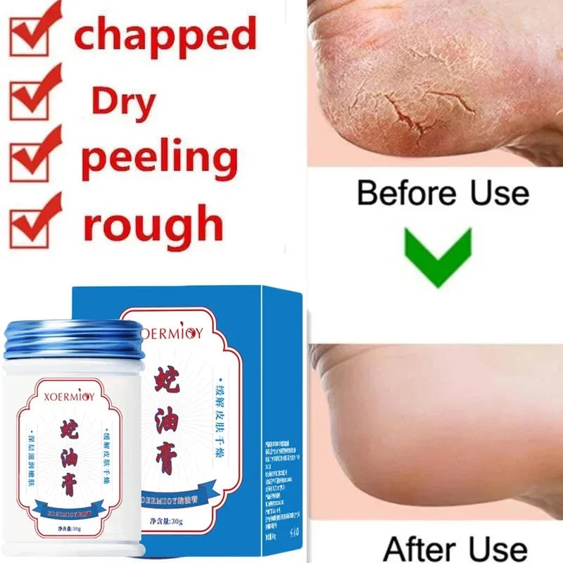 Herbal Anti Crack Foot Cream Heel Cracking Repair Products Exfoliation Dead Skin Removal Softening Moisturize Smooth Skin Care