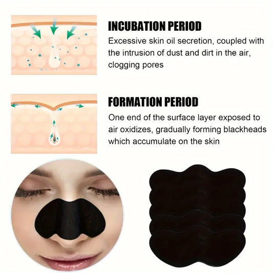 Facial Blackhead Removal Stickers – 10/50/100 Pieces for Deep Pore & Nose Cleansing, Gentle Care