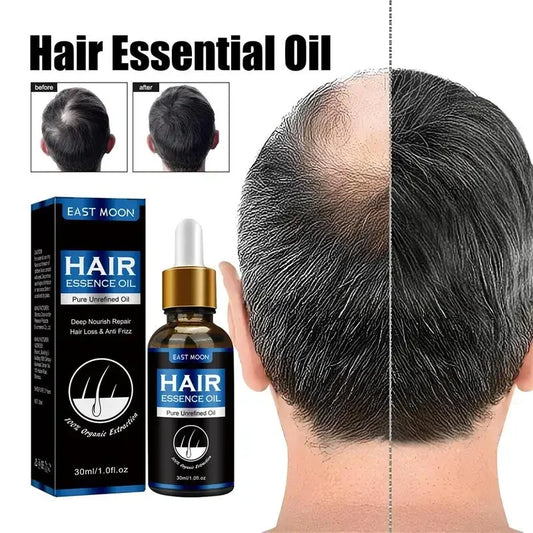 Hair Growth Oil – Effective Solution for Rapid Repair, Baldness, Postpartum Hair Loss & Hereditary Follicle Support