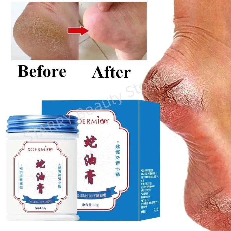 Herbal Anti Crack Foot Cream Heel Cracking Repair Products Exfoliation Dead Skin Removal Softening Moisturize Smooth Skin Care