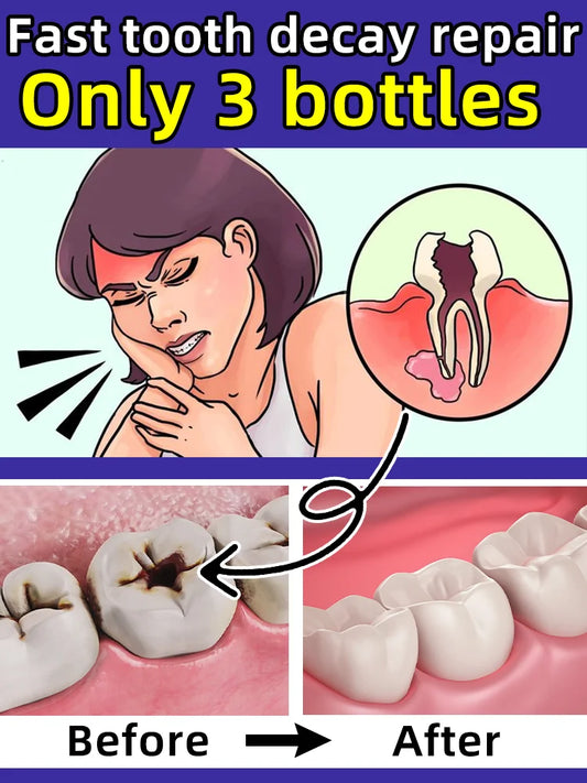 Fast-Acting Cavity & Tooth Decay Solution | Strengthens Enamel & Fights Caries