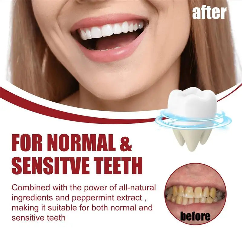 SP-8 Probiotic Toothpaste Whiten Clean Teeth Remove Stains Oral Care Management Fresh Breath With Sodium Saccharin Lactobacillus