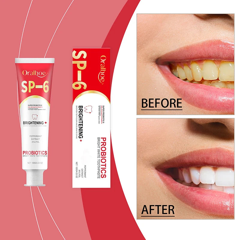 SP-6 Probiotic Toothpaste Whiten Clean Teeth Remove Stains Oral Care Management Fresh Breath With Sodium Saccharin Lactobacillus