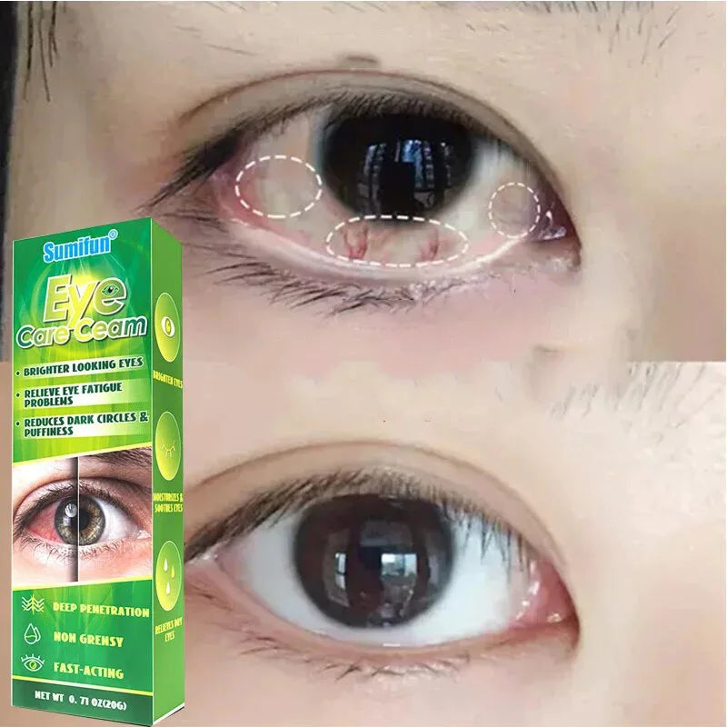 Chinese Herbal Medicine Eye Care Cream Relieve Eye Fatigue Brighter Looking Eyes Problems Reduces Dark Circles And Puffiness