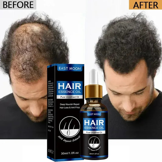 Hair Growth Oil – Effective Solution for Rapid Repair, Baldness, Postpartum Hair Loss & Hereditary Follicle Support