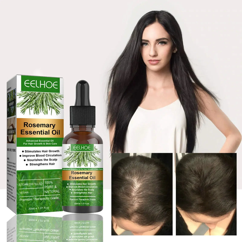 Rosemary Essentiall Oil Hair Growth Products Organic Hair Products Scalp Hair Strengthening Oil For Nourish Shiny Hairs Healthy