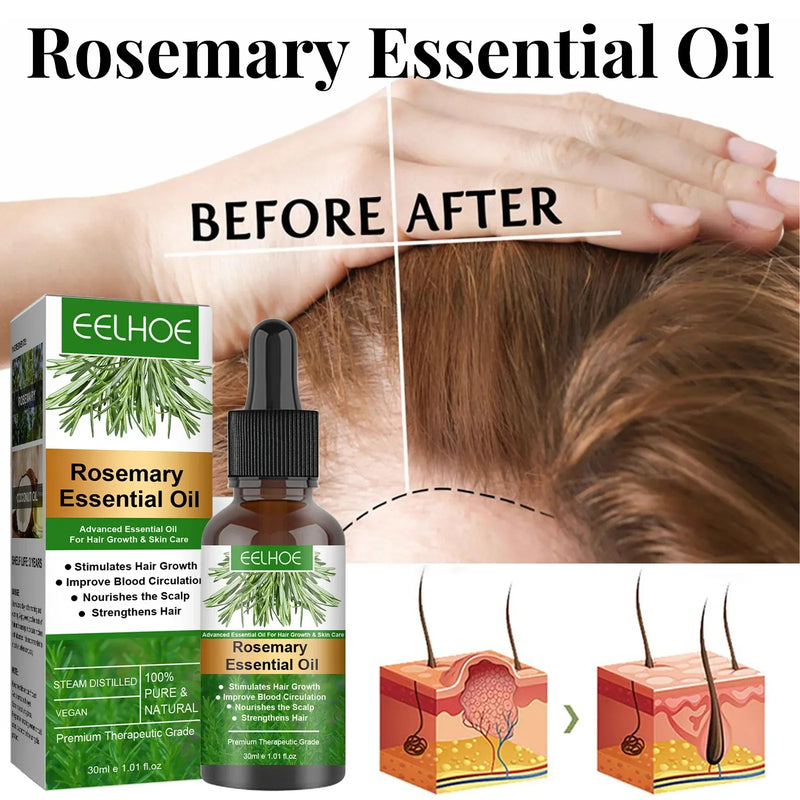 Rosemary Essentiall Oil Hair Growth Products Organic Hair Products Scalp Hair Strengthening Oil For Nourish Shiny Hairs Healthy