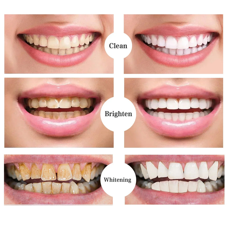 Teeth Whitening Toothpaste Fast Remove Smoke Coffee Tea Stains Cleaning Oral Hygiene Plaque Fresh Breath Bleaching Dental Tools