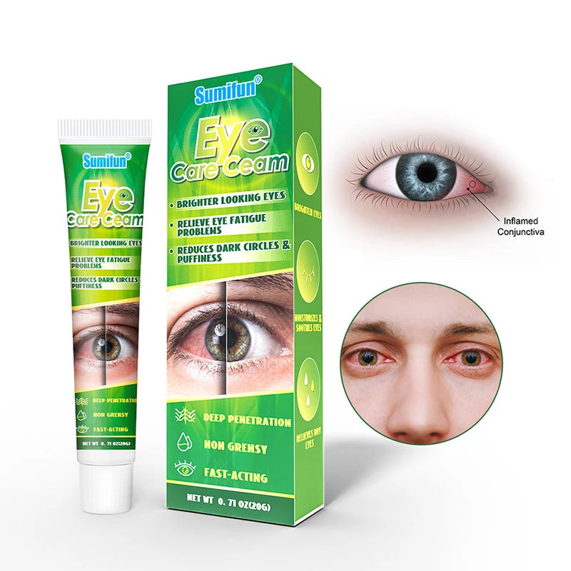 Chinese Herbal Medicine Eye Care Cream Relieve Eye Fatigue Brighter Looking Eyes Problems Reduces Dark Circles And Puffiness