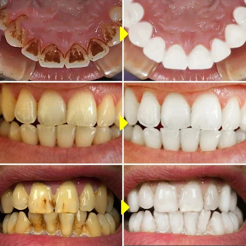 Teeth Whitening Toothpaste Fast Remove Smoke Coffee Tea Stains Cleaning Oral Hygiene Plaque Fresh Breath Bleaching Dental Tools